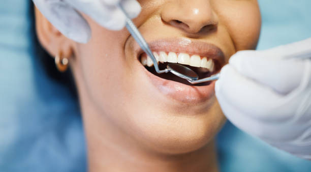 Best Emergency Dental Services for Seniors in Bel Ridge, MO