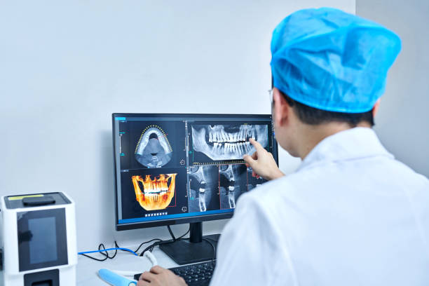 Best Emergency Dentist for Lost Fillings or Crowns in Bel Ridge, MO